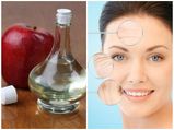 ആപ്പിള്‍ സിഡാര്‍ വിനീഗര്‍ മതി പ്രായം കുറയ്ക്കാന്‍