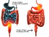 ശരീരത്തിലെ വിഷം അടുക്കളയില്‍ കളയാം