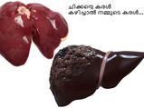 ചിക്കന്റെ കരള്‍ കഴിച്ചാല്‍ നമ്മുടെ കരള്‍...