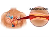 കൊളസ്‌ട്രോള്‍ കുറയുമെന്ന് ഉറപ്പ് തരും ഒറ്റമൂലി