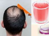 Home Remedies Using Onion Stimulate Hair Growth