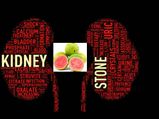 കിഡ്‌നി സ്‌റ്റോണ്‍: 7 ദിന പേരയ്ക്ക പ്രയോഗം
