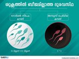 ശുക്ലത്തിൽ ബീജമില്ലാത്തത് പുരുഷവന്ധ്യത വില്ലൻ