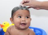 Dandruff In Babies Symptoms Causes And Home Remedies