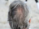 Causes Of Your Hair Turned Grey Early