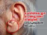 ചെവിയിലെ ഈ മാറ്റങ്ങളുണ്ടോ നിങ്ങളില്‍ ? അപകടം