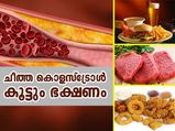 ചീത്ത കൊളസ്‌ട്രോള്‍ കൂട്ടും, ആരോഗ്യം നശിക്കും; ഒഴിവാക്കണം ഇതെല്ലാം