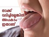 ദിവസവും നാക്ക് വടിക്കണമെന്ന് പറയുന്നത് വെറുതേയല്ല