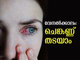 വേനല്‍ക്കാലം ചെങ്കണ്ണിന്റെ കാലം; കരുതിയിരിക്കണം
