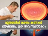 ആണുങ്ങളുടെ മൂത്രത്തില്‍ രക്തം കണ്ടാല്‍ അപകടം