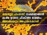 Yellow Fungus : വൈറ്റ് ഫംഗസിന് പുറമേ യെല്ലോ ഫംഗസും; ഏറ്റവും അപകടകാരി, ലക്ഷണങ്ങള്‍ ഇതാ