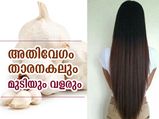 അതിവേഗം താരനകലും മുടിയും വളരും; മുടിക്ക് വെളുത്തുള്ളി പായ്ക്ക്‌