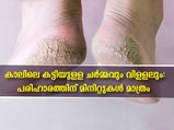 കാലില്‍ കട്ടിയുള്ള ചര്‍മ്മം ഇനിയില്ല: അഞ്ച് മിനിറ്റില്‍ പരിഹാരമിതാ