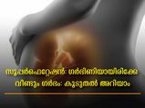 ഗര്‍ഭിണിയായിരിക്കേ വീണ്ടും ഗര്‍ഭിണിയായി: ഇരട്ടക്കുട്ടികള്‍ക്ക് ജന്മം നല്‍കി യുവതി