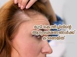 മുടികൊഴിച്ചിലും താരനുമൊക്കെയാണോ പ്രശ്‌നം? ഈ കാരണങ്ങള്‍ അറിഞ്ഞ് വേണം ചികിത്സ