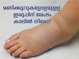 ഇരുന്നെഴുന്നേല്‍ക്കുമ്പോള്‍ കാലില്‍ നീരോ: ഹൃദയവും വൃക്കയും പണിമുടക്കിലേക്ക്‌