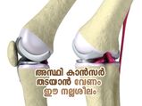 അസ്ഥികളെ പിടികൂടുന്ന കാന്‍സര്‍ മാരകം; ഈ ജീവിതരീതി ശീലിച്ചാല്‍ രക്ഷ