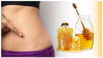 Different Ways To Use Honey To Treat Stretch Marks In Malayalam