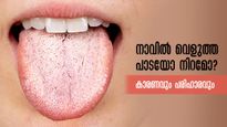 നാവില്‍ വെളുത്ത നിറമോ, നിങ്ങള്‍ക്കുണ്ടോ? നിസ്സാരമാക്കല്ലേ, ശ്രദ്ധിക്കണം