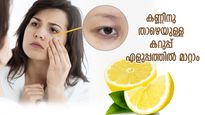 കണ്ണിനു ചുറ്റുമുള്ള കറുപ്പ് നിശ്ശേഷം നീക്കാം; ഈ 4 വിധത്തില്‍ നാരങ്ങ ഉപയോഗിക്കൂ