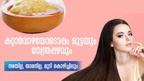 സമൃദ്ധമായ ഉളള് വരാനും താരനകറ്റാനും കറ്റാര്‍വാഴ ഇപ്രകാരം ഉപയോഗിക്കാം