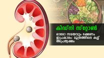 World Kidney Day 2023 Best Diet Plan For Kidney Stone Details In Malayalam