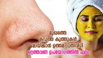 മുഖത്തെ ബ്ലാക്ക്ഹെഡ്സ് നീക്കാന്‍ മഞ്ഞള്‍; ചുരുങ്ങിയ ഉപയോഗത്തില്‍ ഫലം; ഇങ്ങനെ തേക്കണം