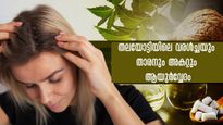 താരന്റെ മൂല കാരണം തലയോട്ടിയില വരള്‍ച്ച: ആയുര്‍വ്വേദത്തില്‍ പരിഹാരം
