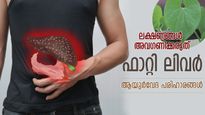 ഫാറ്റി ലിവറിനെ ചെറുക്കാം, ശരീരം രക്ഷിക്കാം; ആയുര്‍വേദം പറയും വഴിയിത്
