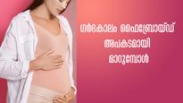 ഗര്‍ഭിണികളില്‍ അടിവയറ്റില്‍ വേദന കൂടുന്നോ: ഫൈബ്രോയ്ഡ് കുഞ്ഞിന് വില്ലനാവാം