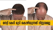 മുടി വളരുന്നില്ല ഉള്ള മുടിയുടെ കട്ടി കുറയുന്നു: 8 കാരണങ്ങളുണ്ട് പുറകില്‍