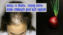 നെറ്റികേറി മുടി കൊഴിഞ്ഞോ: ആണ്‍പെണ്‍വ്യത്യാസമില്ലാതെ രണ്ടാഴ്ച ഉപയോഗിക്കൂ: സവാള സെറം