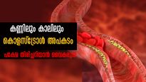 കൊളസ്‌ട്രോള്‍ കൂടുന്നതിന്റെ ഗുരുതര ലക്ഷണം കാലിലും നാവിലും സ്‌പോട്ടിലറിയാം