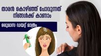 എണ്ണ തേച്ചിട്ടും ഷാമ്പൂ തേച്ചിട്ടും താരന്‍ അടങ്ങുന്നില്ലേ: പരിഹാരം ഇനി ഭക്ഷണത്തിലാണ്