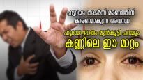 ഹൃദയാഘാതം മുന്‍കൂട്ടി കാട്ടിത്തരും കണ്ണിലെ മാറ്റം; ഈ ലക്ഷണങ്ങള്‍ അപകടം