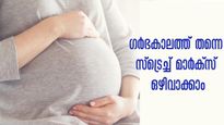 ഗര്‍ഭകാലത്ത് തന്നെ അല്‍പം ശ്രദ്ധിച്ചാല്‍ സ്‌ട്രെച്ച് മാര്‍ക്‌സ് മായ്ച്ച് കളയാം