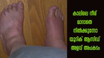 3 പഴങ്ങള്‍ ആയുസ്സ് കൂട്ടും: യൂറിക് ആസിഡ്, സന്ധിവേദന കണ്ണടച്ച് തുറക്കും മുന്‍പ് പരിഹാരം