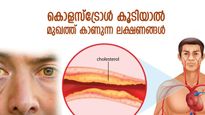 ശരീരത്തില്‍ കൊളസ്‌ട്രോള്‍ കൂടുന്നുണ്ടോ? മുഖത്ത് പ്രകടമാകും ഈ ലക്ഷണങ്ങള്‍