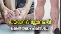 പാദങ്ങളില്‍ മരവിപ്പ്, ബലഹീനത; ഡയബറ്റിക് ന്യൂറോപ്പതി തിരിച്ചറിയാം, പ്രമേഹ രോഗികള്‍ അറിയേണ്ടത്‌