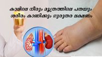 മൂത്രത്തില്‍ പതയും കാലില്‍ നീരും ഒരുമിച്ച് കണ്ടാല്‍ വൃക്കരോഗം വിട്ടുമാറില്ല