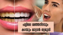 വായ്‌നാറ്റം, പല്ലിലെ കറ, മഞ്ഞ നിറം: ഗ്യാരണ്ടിയോടെ ഇല്ലാതാക്കും അടുക്കളയിലെ ഔഷധക്കൂട്ട്