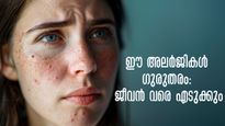 ഭക്ഷണശേഷം ഛര്‍ദ്ദി, ചര്‍മ്മത്തില്‍ തടിപ്പ്, ശ്വാസനാളത്തില്‍ വീക്കം: അലര്‍ജികള്‍ പലതരം