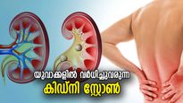 യുവാക്കളില്‍ വര്‍ധിച്ചുവരുന്ന കിഡ്‌നി സ്‌റ്റോണ്‍; കാരണങ്ങള്‍ അറിഞ്ഞ് വേണം ചികിത്സ