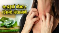 അലര്‍ജ്ജി ഇനി ചര്‍മ്മത്തില്‍ അടുക്കില്ല; ഒറ്റയടിക്ക് നീക്കുന്ന വീട്ടുവൈദ്യങ്ങള്‍