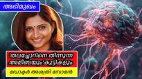 ബ്രെയിന്‍ ഈറ്റിംഗ് ബാക്ടീരിയ; 'ഭയപ്പെടുത്തുകയല്ല കുട്ടികളെ കാര്യങ്ങള്‍ പറഞ്ഞ് മനസ്സിലാക്കുക', ഡോക്ടര്‍ അശ്വതി