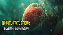 തിരിച്ചറിഞ്ഞില്ലെങ്കില്‍ ജീവന് ഭീഷണിയാകും, ലക്ഷണങ്ങള്‍ 5 വയസ്സ് മുതല്‍; എന്താണ് വില്‍സണ്‍സ് രോഗം