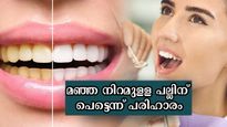 മഞ്ഞ നിറമുള്ള പല്ലിന് വിട, ഇനി മുല്ലപ്പൂ മൊട്ടുപോലുള്ള പല്ലിനായി ഇത് മാത്രം