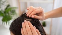 How Ayurveda Helps Stop Hair Loss After Delivery Details Inside