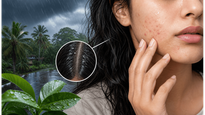 Monsoon Skincare And Haircare Tips Protection For Skin And Scalp During Heavy Rain 011