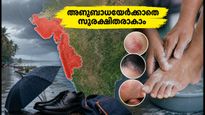 മഴക്കാലത്തെ ചർമ്മരോഗങ്ങൾ പേടിപ്പെടുത്തുന്നുണ്ടോ? അണുബാധയേൽക്കാതെ സുരക്ഷിതരാകാൻ ഈ ലളിത വഴികൾ പരീക്ഷിക്കൂ